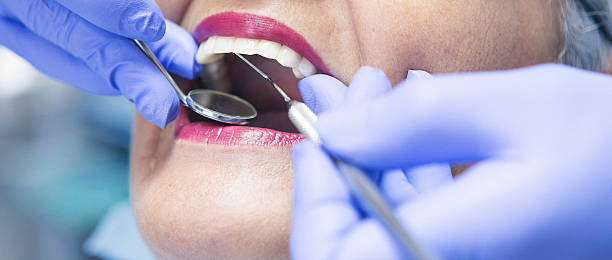 Best Emergency Dentist for Knocked-Out Tooth in Buckley, WA